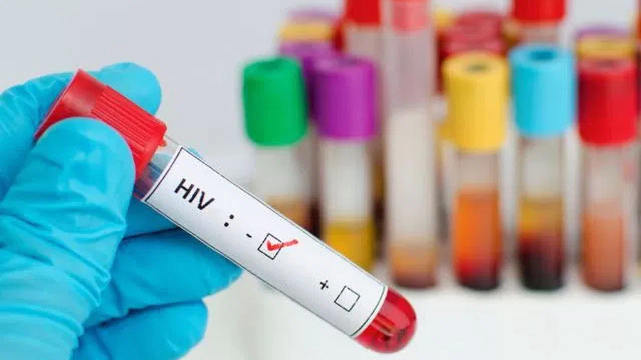 HIV’den korunmak için tek eşliliğe ve kondoma yönelmek gerekiyor