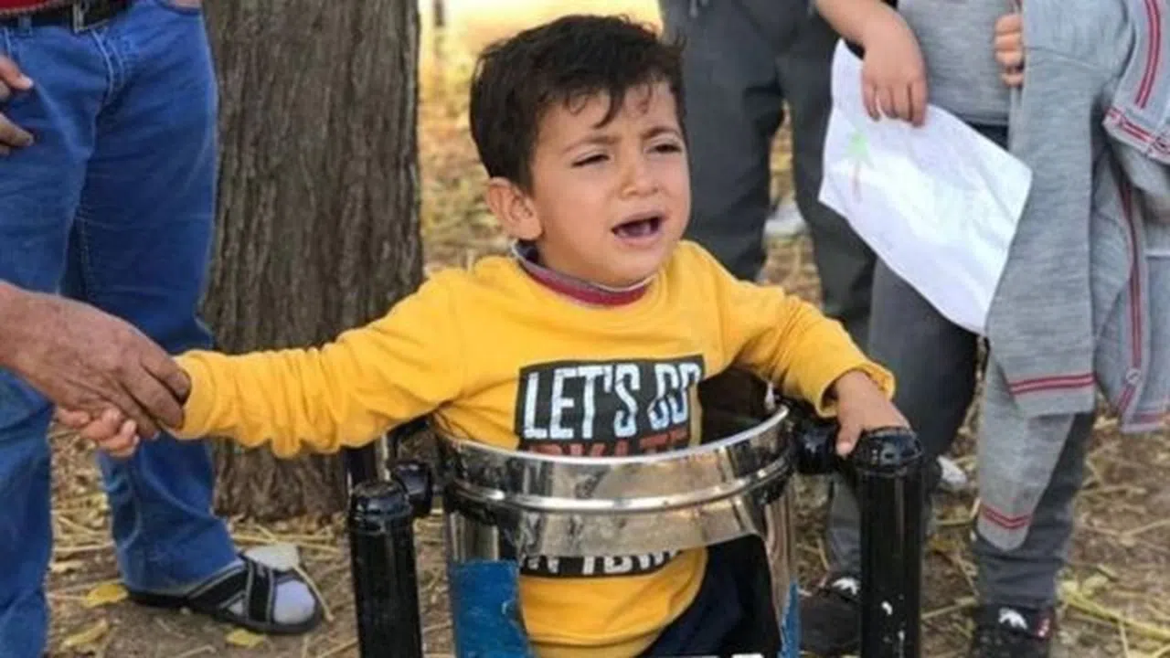 Küçük çocuk parkta oynarken çöp kutusuna sıkıştı