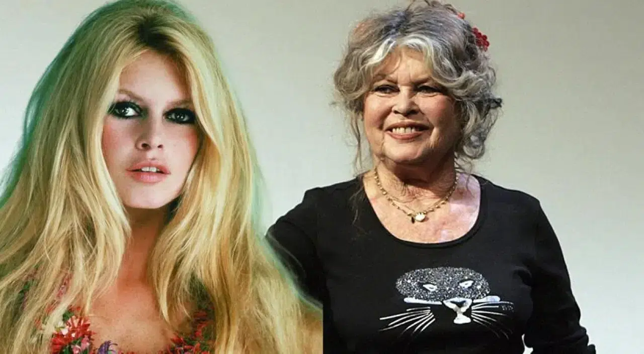 Brigitte Bardot Hastanede Tedavi Altında