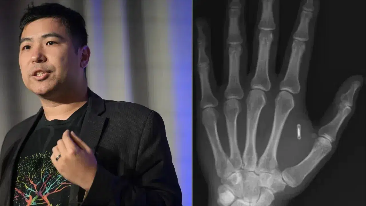 Eline Taktığı Çipin Parolasını Unutan Genç Adamın Başına Gelen İlginç Olay