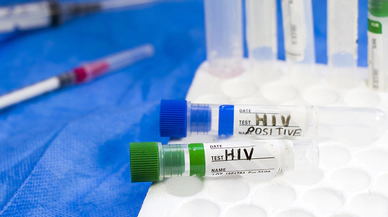 HIV/AIDS Tedavisi ve Hasta Bakımı