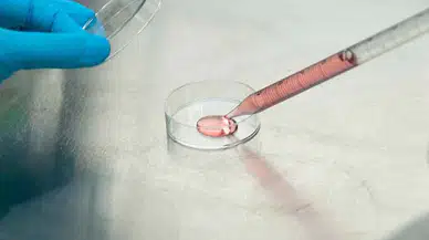 Yardımcı Üreme Tekniklerinde Donmuş Embriyo Transferi