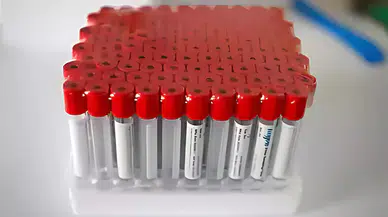 Norovirüs Salgını Kapıda! Nasıl Korunmalıyız?