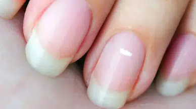 Tırnakta Beyaz Çizgi Varsa Ne Yapmalı? Uzmanlardan 5 Kritik Uyarı!