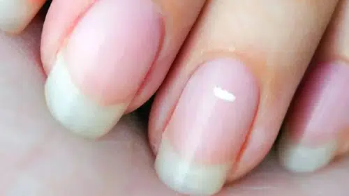 Tırnakta Beyaz Çizgi Varsa Ne Yapmalı? Uzmanlardan 5 Kritik Uyarı!