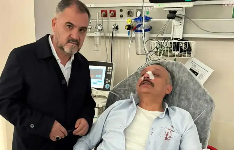 Yozgatta okul müdürünü darbeden veli gözaltına alındı mı?